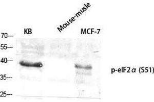 Western Blot (WB) analysis of specific cells using Phospho-eIF2alpha (S51) Polyclonal Antibody.