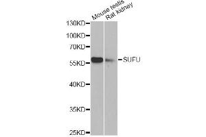 Western blot analysis of extracts of various cell lines, using SUFU antibody (ABIN6293839) at 1:1000 dilution. (SUFUH 抗体)