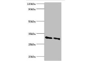 Western blot All lanes: KCTD15 antibody at 8 μg/mL Lane 1: 293T whole cell lysate Lane 2: Hela whole cell lysate Secondary Goat polyclonal to rabbit IgG at 1/10000 dilution Predicted band size: 32, 27 kDa Observed band size: 32 kDa (KCTD15 抗体  (AA 1-234))