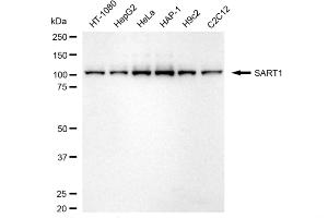 Western blotting analysis using SART1 antibody (ABIN7800429).