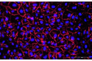 HUVEC cells were stained using a primary rabbit anti-human CD31 antibody, followed by detection with animal-free AlexaFluor555-conjugated anti-rabbit IgG secondary Multiclonal antibody (ABIN7581785). (Recombinant 小鼠 anti-兔 IgG Antibody (Alexa Fluor 555))