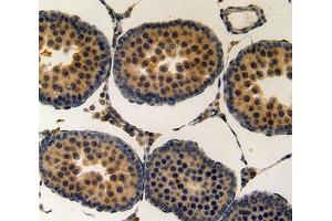 Used in DAB staining on fromalin fixed paraffin- embedded testis tissue (KRT15 抗体  (AA 94-402))