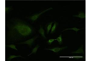 Immunofluorescence (IF) image for anti-Proliferating Cell Nuclear Antigen (PCNA) (AA 78-177) antibody (ABIN518693)