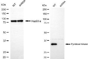 Western blotting analysis using pyridoxal kinase antibody (ABIN7800072).