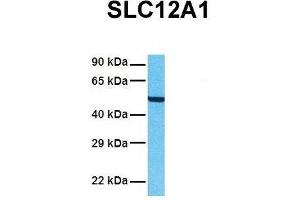 Host:  Rabbit  Target Name:  SLC12A1  Sample Tissue:  Human A549  Antibody Dilution:  1. (SLC12A1 抗体  (N-Term))