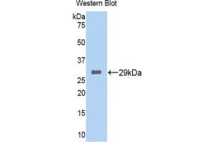 Western blot analysis of the recombinant protein. (TPSB2 抗体  (AA 35-275))