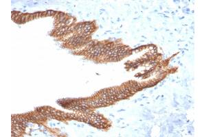 Immunohistochemistry (IHC) image for anti-Tumor-Associated Calcium Signal Transducer 2 (TACSTD2) (AA 31-274) antibody (ABIN6939972)