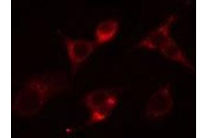 ABIN6266546 staining Hela cells by IF/ICC. (Glucagon 抗体)