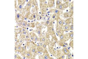 Immunohistochemistry of paraffin-embedded Human liver injury using KIF3A antibody at dilution of 1:100 (x400 lens). (KIF3A 抗体)