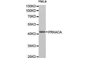 Western blot analysis of extracts of HeLa cells, using PRKACA antibody (ABIN5995919). (PRKACA 抗体)