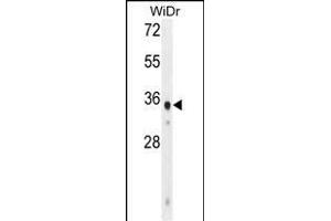 WDR5B Antibody (N-term) (ABIN655005 and ABIN2844640) western blot analysis in WiDr cell line lysates (35 μg/lane). (WDR5B 抗体  (N-Term))