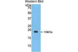 Detection of Recombinant F8, Human using Polyclonal Antibody to Coagulation Factor VIII (F8) (Factor VIII 抗体  (AA 1887-2044))