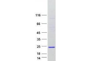 Western Blotting (WB) image for CGRP Receptor Component (CRCP) (Transcript Variant 1) protein (Myc-DYKDDDDK Tag) (ABIN2712548)
