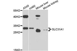 Western blot analysis of extracts of various cell lines, using SLC31A1 antibody (ABIN6003807) at 1/1000 dilution. (SLC31A1 抗体)