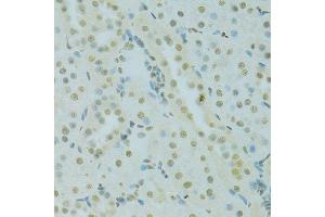 Immunohistochemistry (Paraffin-embedded Sections) (IHC (p)) image for anti-Scaffold Attachment Factor B (SAFB) (AA 1-200) antibody (ABIN6147357)