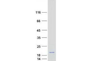 Western Blotting (WB) image for C1D Nuclear Receptor Corepressor (C1D) (Transcript Variant 1) protein (Myc-DYKDDDDK Tag) (ABIN2715441)