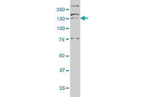AATK monoclonal antibody (M03), clone 5B8 Western Blot analysis of AATK expression in Hela S3 NE . (AATK 抗体  (AA 161-260))