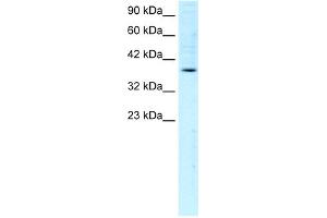 WB Suggested Anti-FOSB Antibody Titration:  1. (FOSB 抗体  (C-Term))