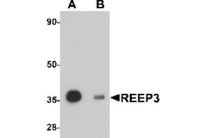 Western Blotting (WB) image for anti-Receptor Accessory Protein 3 (REEP3) (C-Term) antibody (ABIN1030616)