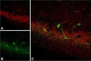 Expression of SSTR4 in rat hippocampus - Immunohistochemical staining of rat hippocampus using Anti-Somatostatin Receptor Type 4 (extracellular) Antibody, (ABIN7043766, ABIN7045265 and ABIN7045266). (SSTR4 抗体  (2nd Extracellular Loop))