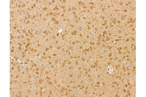 ABIN6260322 and ABIN6279883 at 1/100 staining rat brain tissue by IHC-P. (BTF3L4 抗体  (Internal Region))