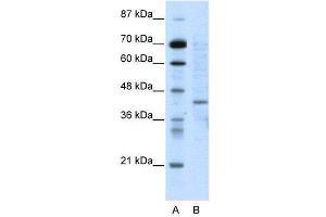 WB Suggested Anti-RING1  Antibody Titration: 5. (RING1 抗体  (N-Term))