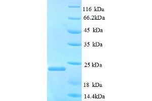 SDS-PAGE (SDS) image for Nitric Oxide Synthase 3 (Endothelial Cell) (NOS3) (AA 519-690) protein (His tag) (ABIN5713030)