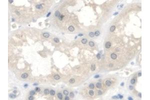 Detection of IGFBP2 in Human Kidney Tissue using Polyclonal Antibody to Insulin Like Growth Factor Binding Protein 2 (IGFBP2)
