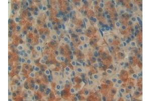 Immunohistochemistry (IHC) image for anti-Insulin-Like Growth Factor Binding Protein 7 (IGFBP7) (AA 88-281) antibody (ABIN7439126)