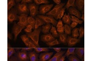 Immunofluorescence analysis of U-2 OS cells using NEXN Polyclonal Antibody at dilution of 1:100. (NEXN 抗体)