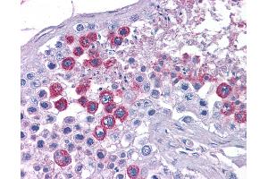 Anti-ATP11A antibody IHC of human testis. (ATP11A 抗体  (N-Term))