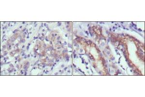 Immunohistochemical analysis of paraffin-embedded human gastric cancer (left) and normal gastric tissues (right) using CER1 mouse mAb with DAB staining. (CER1 抗体)