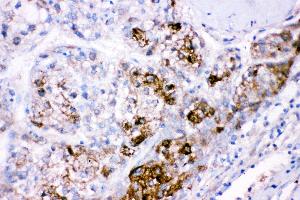Immunohistochemistry (Paraffin-embedded Sections) (IHC (p)) image for anti-Cystathionine-beta-Synthase (CBS) (AA 331-551) antibody (ABIN3043747) (CBS 抗体  (AA 331-551))