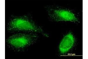 Immunofluorescence (IF) image for anti-Fibronectin 1 (FN1) (AA 1-163) antibody (ABIN515779)
