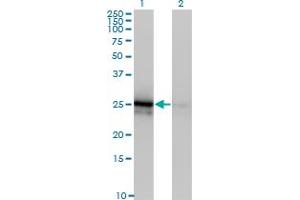 Western Blot analysis of FGF21 expression in transfected 293T cell line by FGF21 monoclonal antibody (M03), clone 3G10. (FGF21 抗体  (AA 30-209))