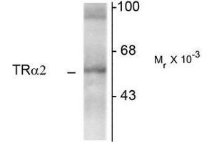 Western Blotting (WB) image for anti-Thyroid Hormone Receptor, alpha (THRA) (N-Term) antibody (ABIN371845) (THRA 抗体  (N-Term))