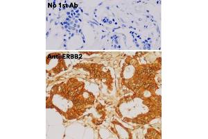 Immunohistochemistry (IHC) image for anti-Receptor tyrosine-protein kinase erbB-2 (ErbB2/Her2) (C-Term) antibody (ABIN6254225) (ErbB2/Her2 抗体  (C-Term))