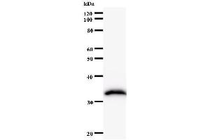 Western Blotting (WB) image for anti-FtsJ RNA Methyltransferase Homolog 2 (FTSJ2) antibody (ABIN931161) (FTSJ2 抗体)