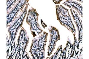 IHC analysis of WAPL/FOE using anti-WAPL/FOE antibody (ABIN7602663).