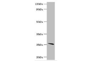 Western blot All lanes: Glutathione S-transferase A2 antibody at 4 μg/mL + Mouse liver tissue Secondary Goat polyclonal to rabbit IgG at 1/10000 dilution Predicted band size: 26 kDa Observed band size: 26 kDa (GSTa2 抗体  (AA 1-222))