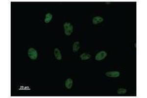 Immunostaining analysis in HeLa cells. (BCL3 抗体)