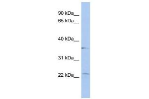 LYSMD2 antibody used at 1 ug/ml to detect target protein. (LYSMD2 抗体  (Middle Region))
