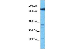 Host:  Rabbit  Target Name:  COMP  Sample Type:  786-0 Whole Cell lysates  Antibody Dilution:  1. (COMP 抗体  (N-Term))