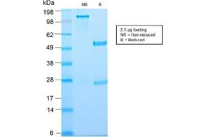 SDS-PAGE Analysis of Purified Thymidine Phosphorylase Rabbit Recombinant Monoclonal (TYMP/2890R). (Recombinant Thymidine Phosphorylase 抗体)