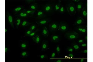 Immunofluorescence of monoclonal antibody to RBBP4 on HeLa cell.