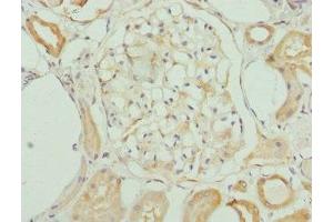 Immunohistochemistry (IHC) image for anti-KH Domain Containing, RNA Binding, Signal Transduction Associated 3 (KHDRBS3) (AA 177-346) antibody (ABIN7157482)