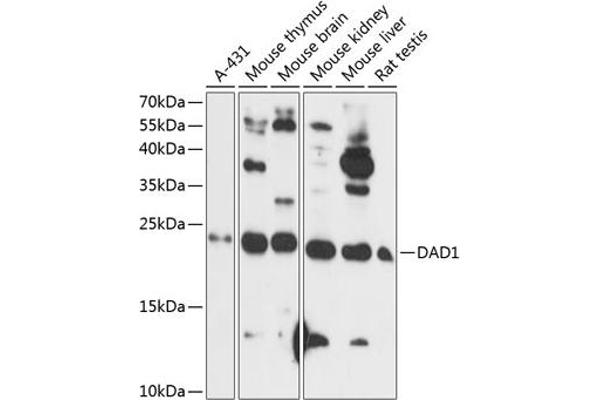 DAD1 抗体  (AA 1-100)
