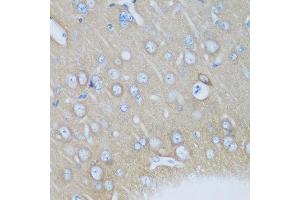 Immunohistochemistry of paraffin-embedded mouse brain using VSNL1 antibody at dilution of 1:200 (40x lens).