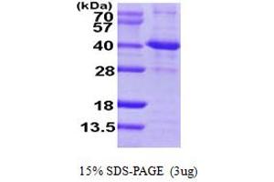 SIRT2 Protein (AA 1-352) (His tag)