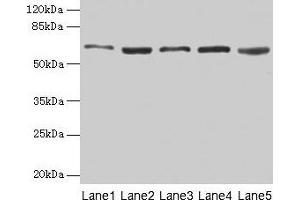 Western blot All lanes: STIP1 antibody at 12 μg/mL Lane 1: Hela whole cell lysate Lane 2: HepG2 whole cell lysate Lane 3: NIH/3T3 whole cell lysate Lane 4: Jurkat whole cell lysate Lane 5: Rat gonadal tissue Secondary Goat polyclonal to rabbit IgG at 1/10000 dilution Predicted band size: 63, 69, 60 kDa Observed band size: 63 kDa (STIP1 抗体  (AA 1-543))